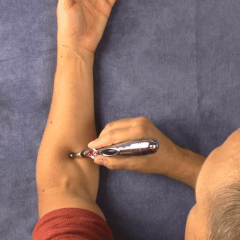 stylo acupuncture avant bras