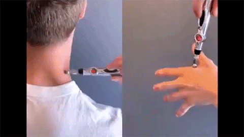 gif stylo acupuncture
